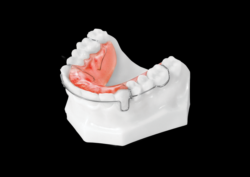 Circumferential Retainer (Upper) view 2